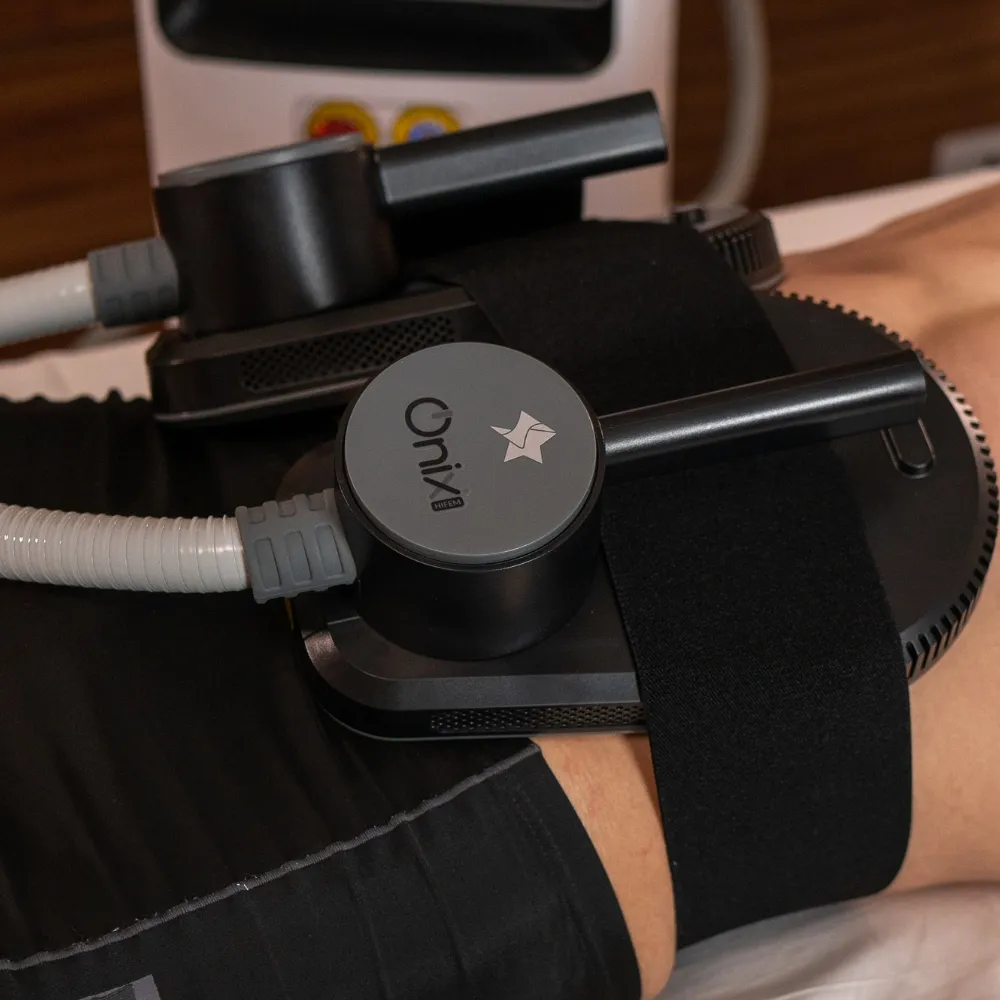 Tratamento com Ônix Duet para fortalecimento muscular, definição corporal e redução de gordura localizada na Clínica Ticiana Pires Estética e SPA