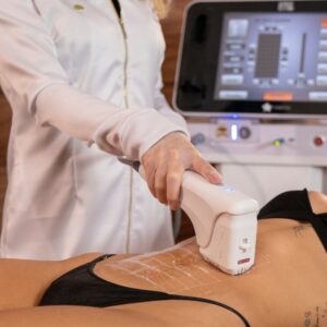Equipamento Herus HIFU 4D utilizado para lifting facial e tratamento de flacidez na Clínica Ticiana Pires