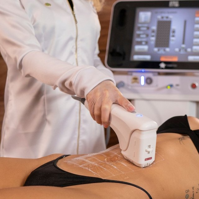 Equipamento Herus HIFU 4D utilizado para lifting facial e tratamento de flacidez na Clínica Ticiana Pires