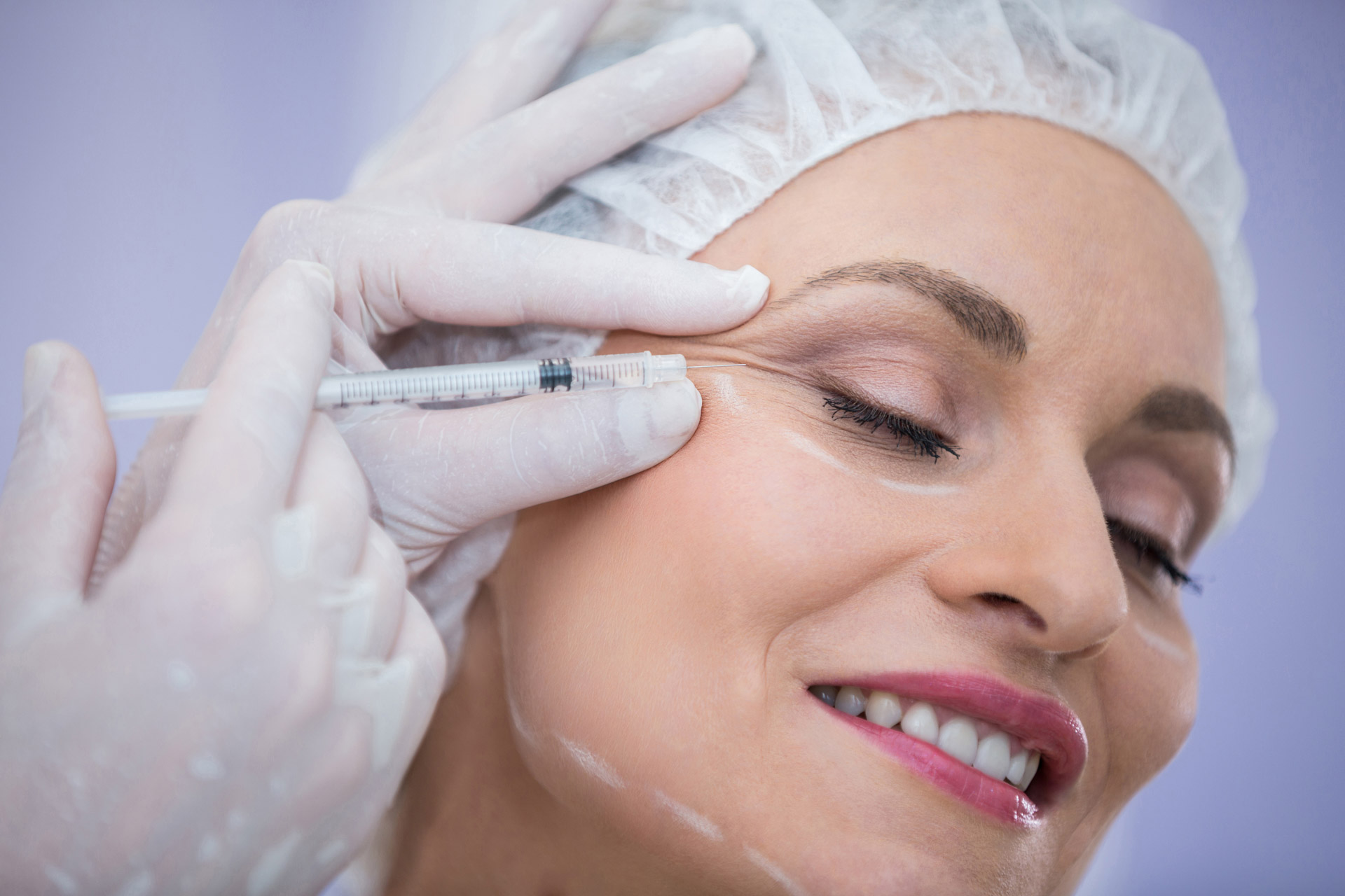Toxina botulínica para suavização de rugas faciais na Clínica Ticiana Pires Estética e SPA