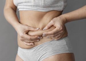 Tratamento estético para gordura localizada na Clínica Ticiana Pires Estética e SPA
