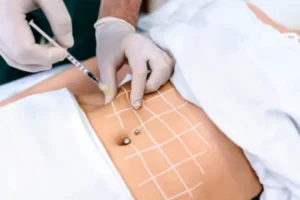 Tratamento estético com esvaziadores de gordura localizada
